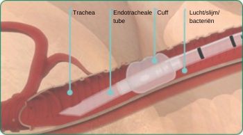 NL-explore-image-oral-care-vap-facts-3