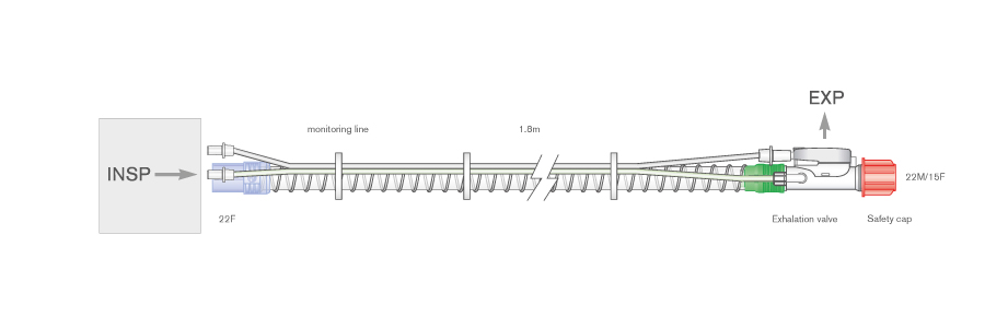 22mm Smoothbore beademingssysteem voor Astral®, flexibele connector, 1.8m met expiratieklep, kleplijn en monitorlijn